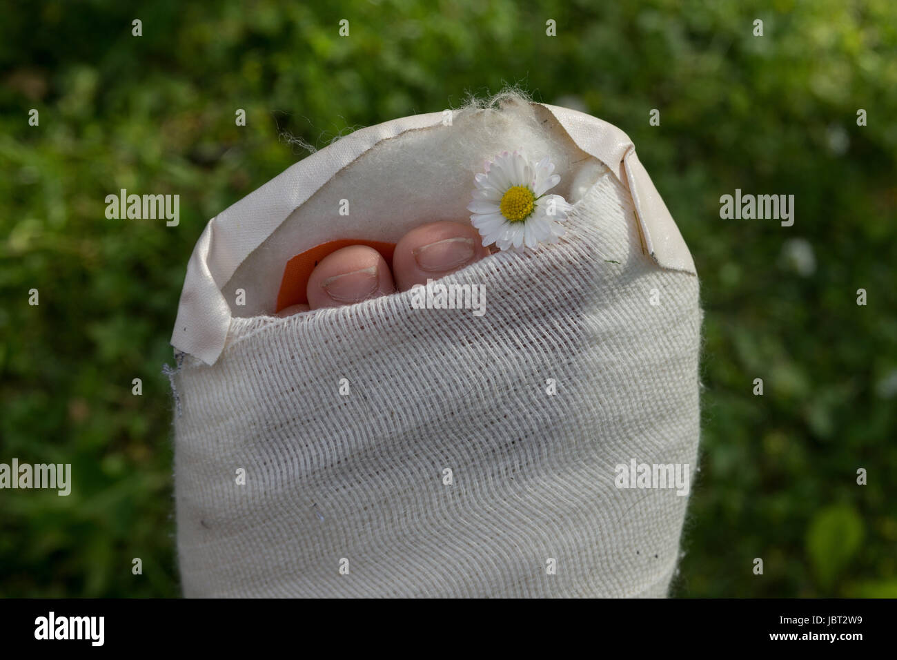 Gipsfuß eines Kindes Stock Photo