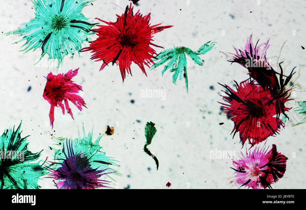 Photomicrograph of an Apple fruit made through an optical microscope