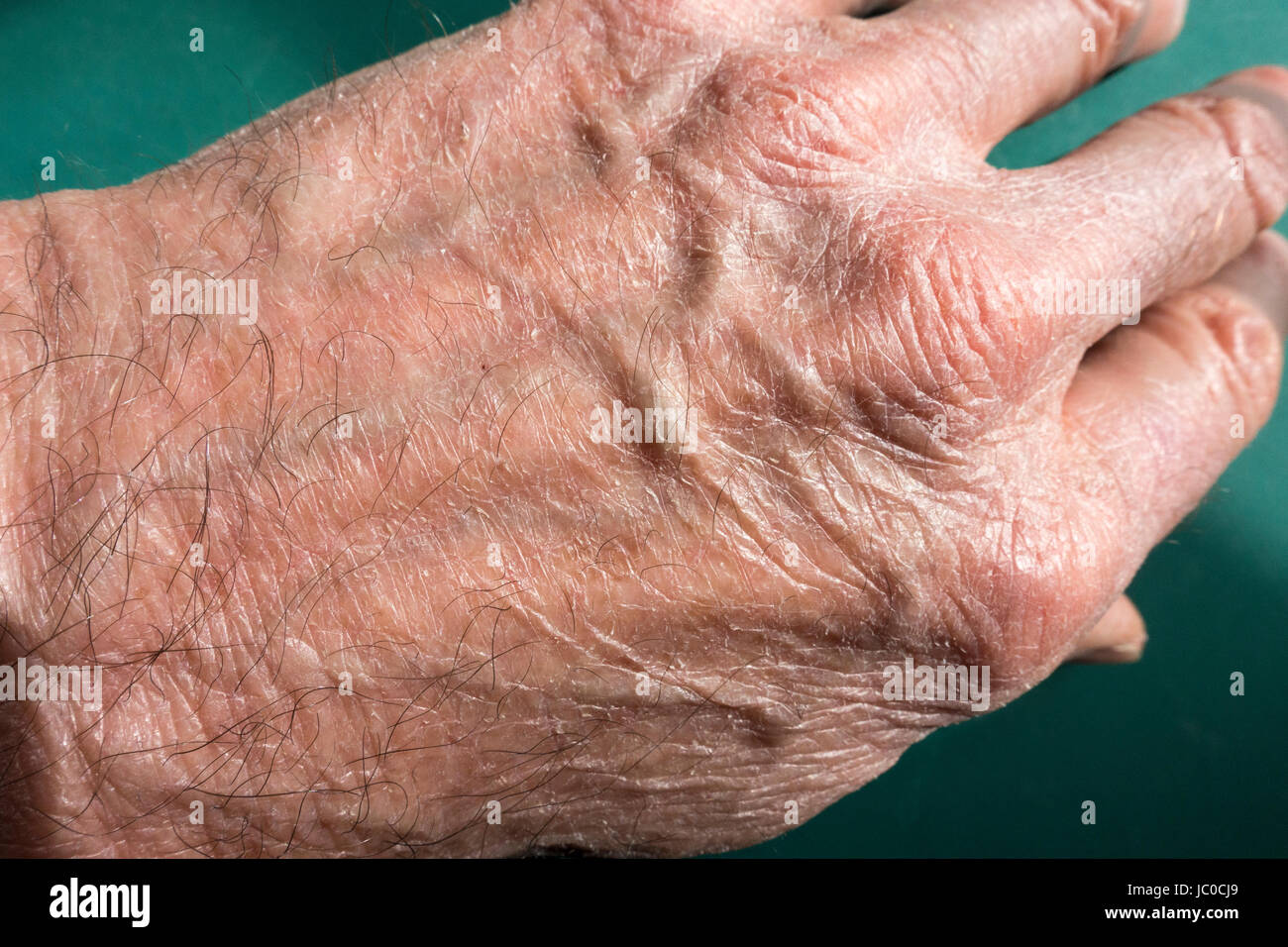 Vein pattern and hairs on back of human hand. Stock Photo