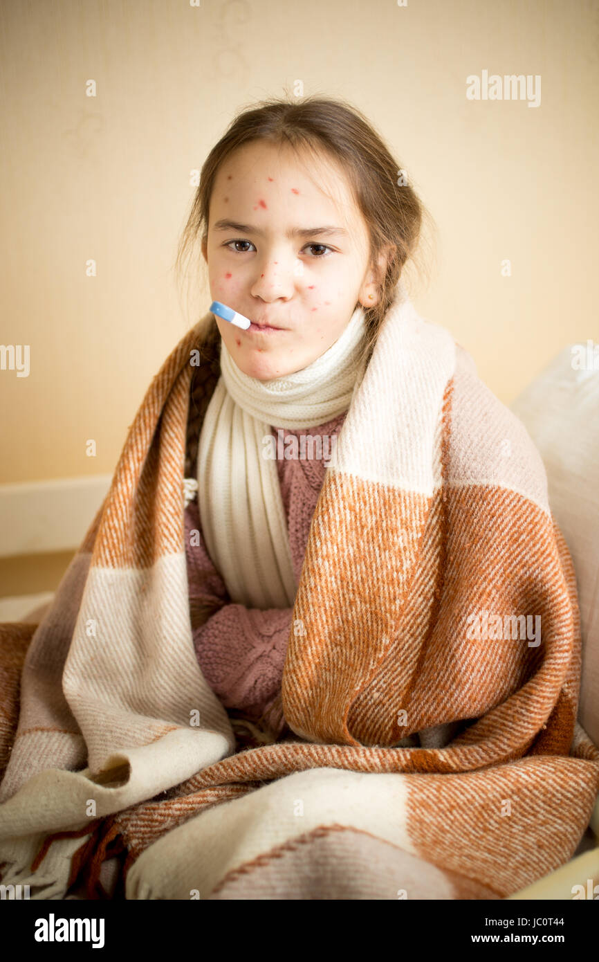 Portrait of sick girl with chickenpox measuring temperature with mouth thermometer Stock Photo