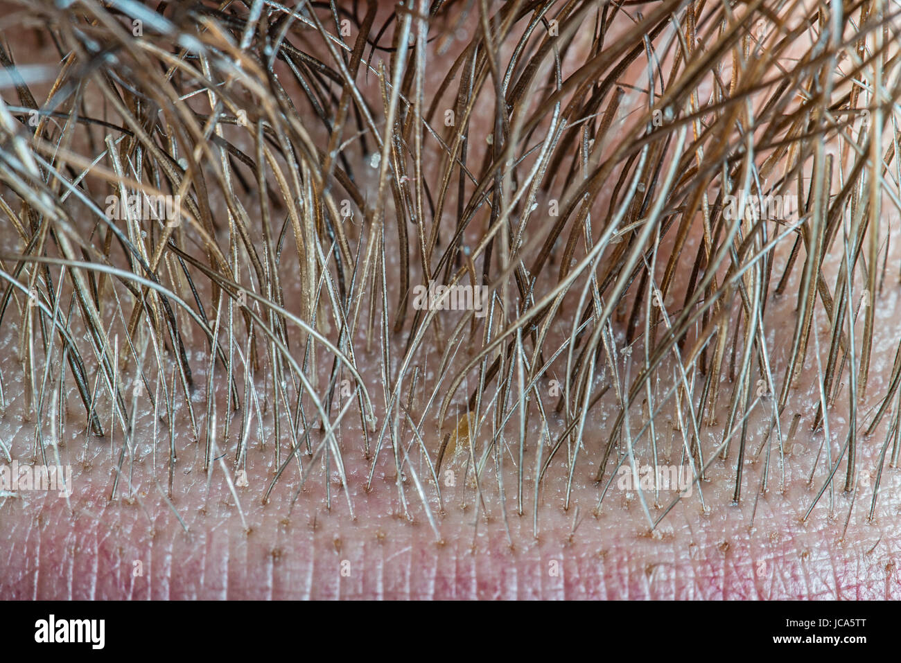 Human male beard hair super close-up view. Magnification about 100 times. Stock Photo