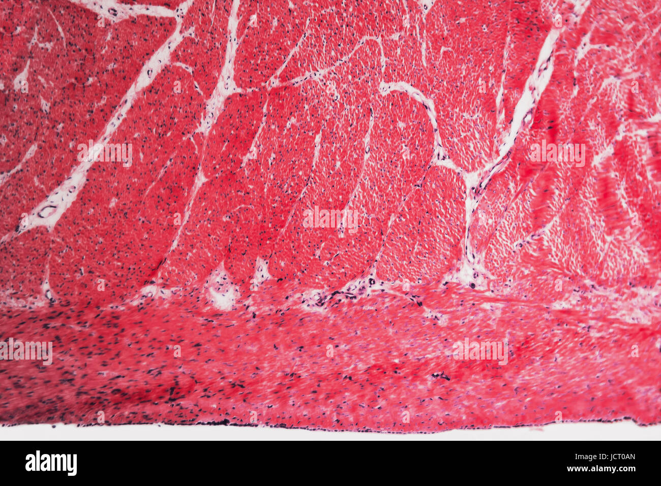 Esophagus cell hi-res stock photography and images - Alamy