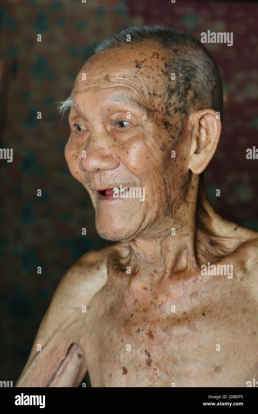 Very old Vietnamese man 95 years old who lived in the same Mekong Delta village all his life. He fought during Americans during the Vietnam war. Stock Photo