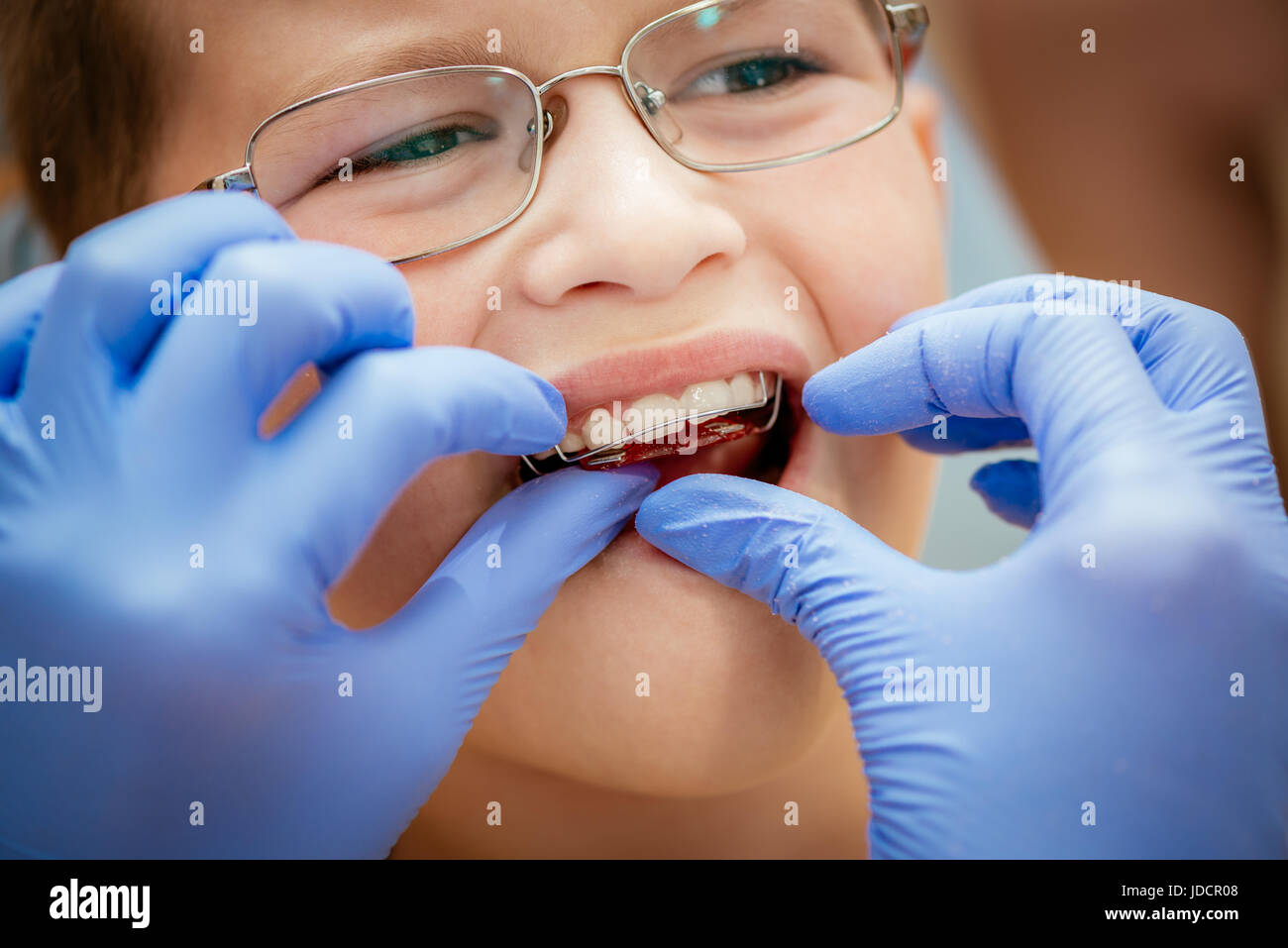 Dentist checking mobile orthodontic appliance for dental correction to