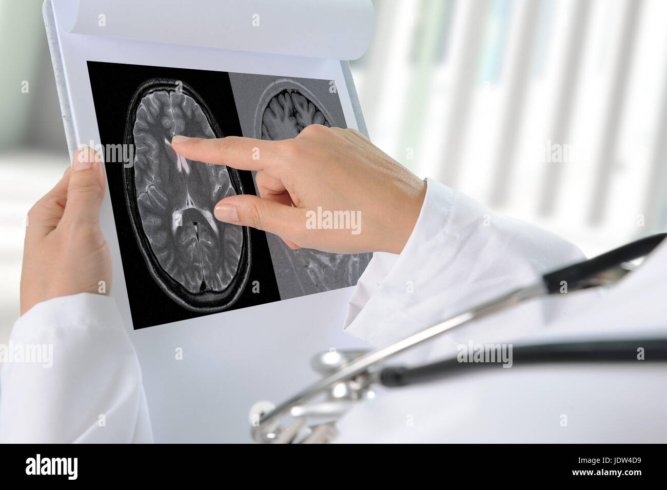 Doctor pointing to printout of brain scan Stock Photo