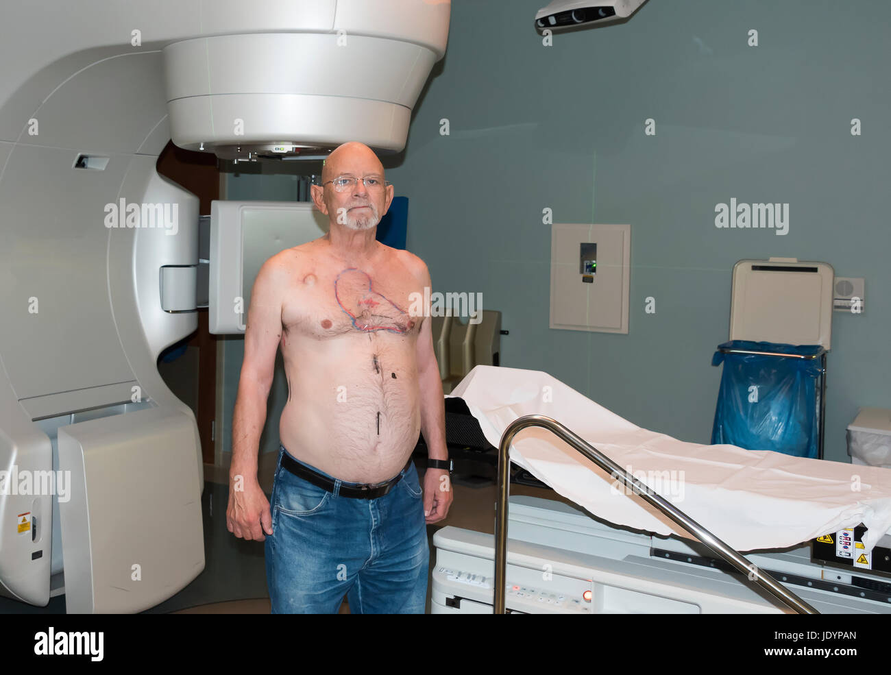 Patient Radiation therapy laser markings lines for targeting cancer cells in the Chest Stock Photo