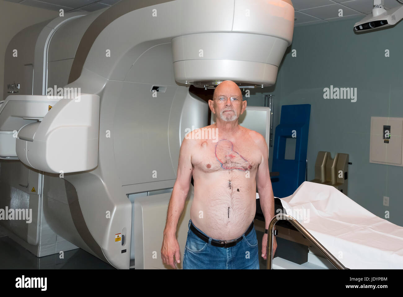 Patient Radiation therapy laser markings lines for targeting cancer cells in the Chest Stock Photo