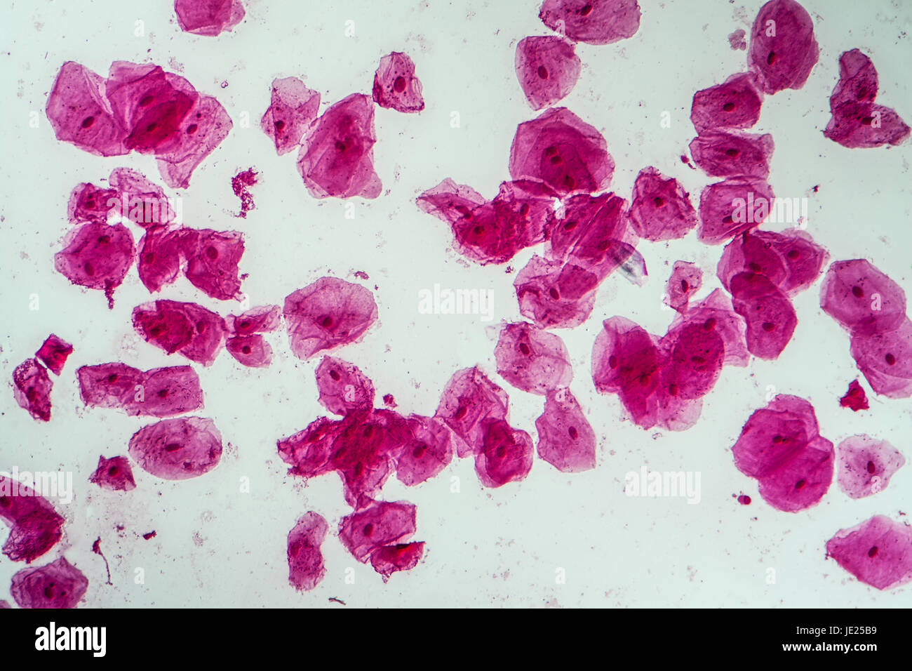 Epithelzellen mit Bakterien aus der Mundhöhle 200x Stock Photo