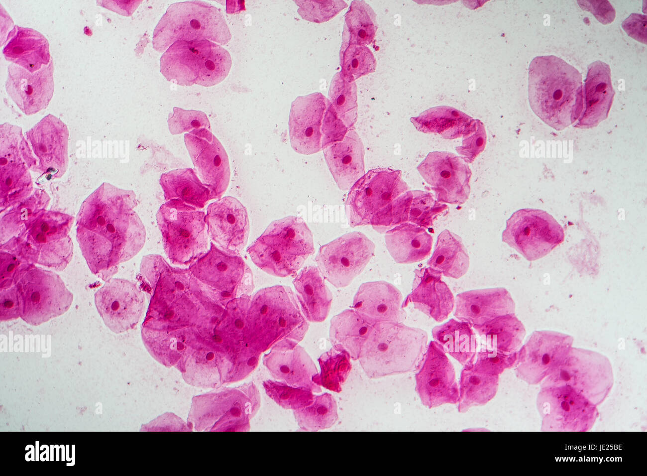 Epithelzellen mit Bakterien aus der Mundhöhle 200x Stock Photo