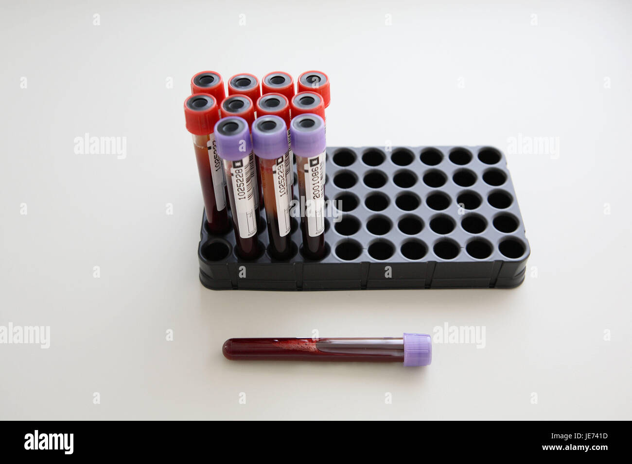 Laboratory, rehearsal stand, test tube, blood, rehearsal, taken, lie