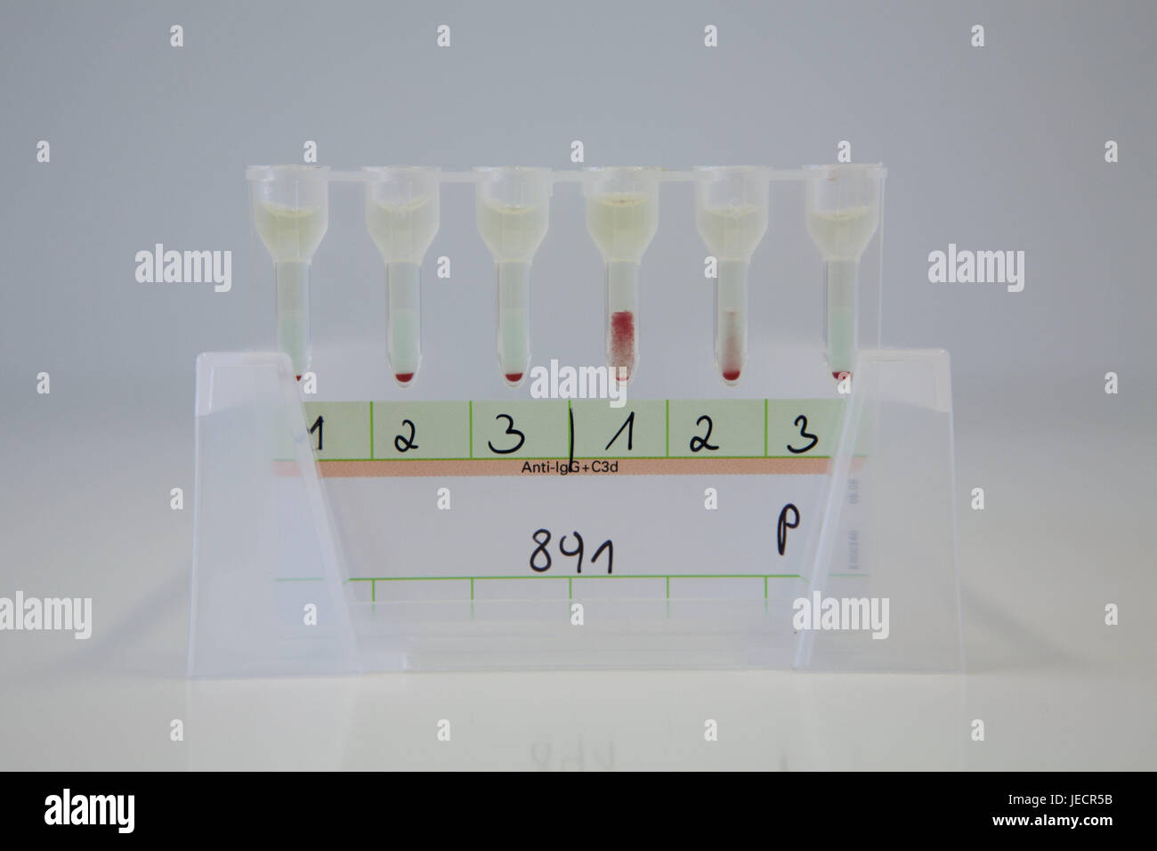 Blood group test hires stock photography and images Alamy
