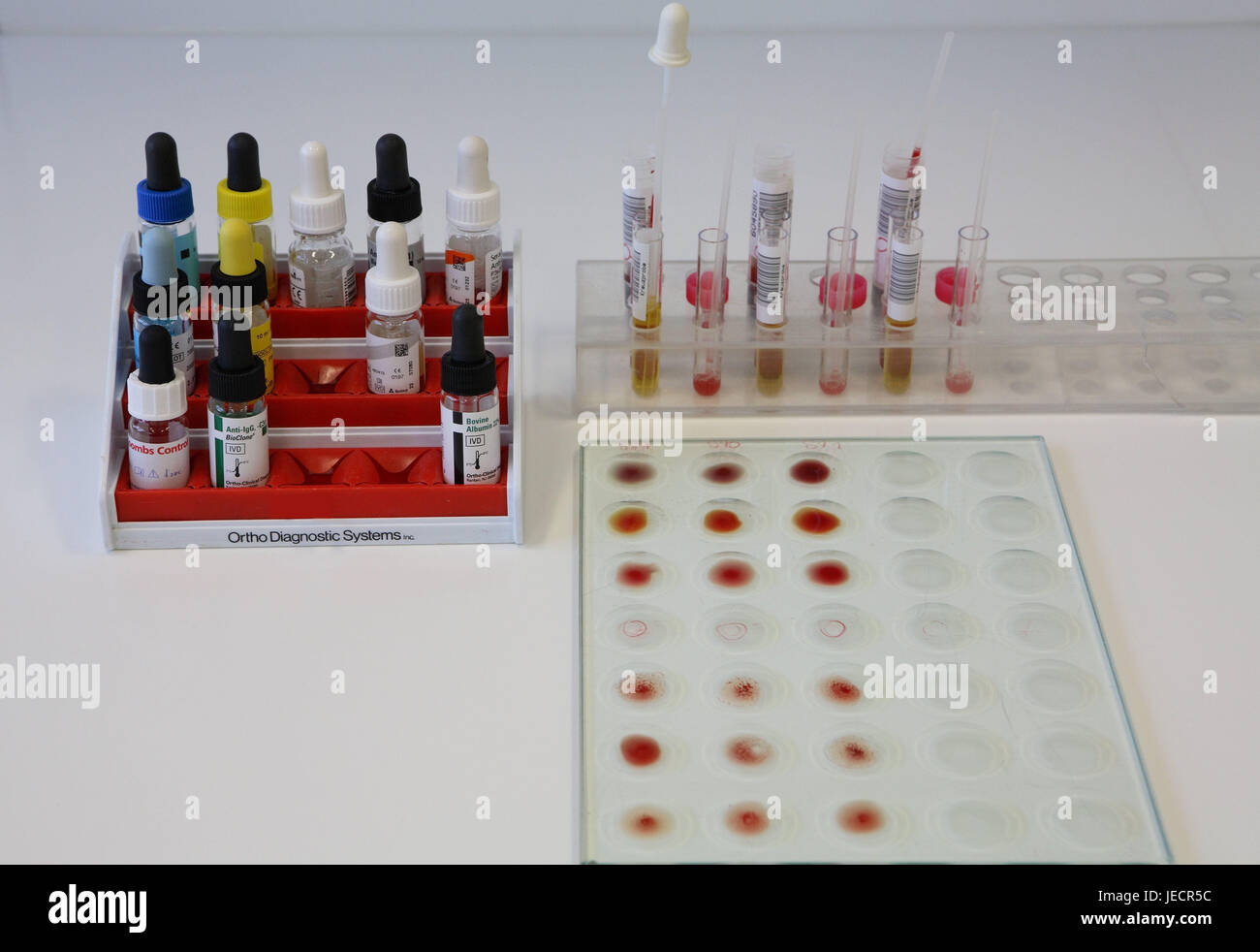 Laboratory, immune haematology, blood tests, serologische compatibility