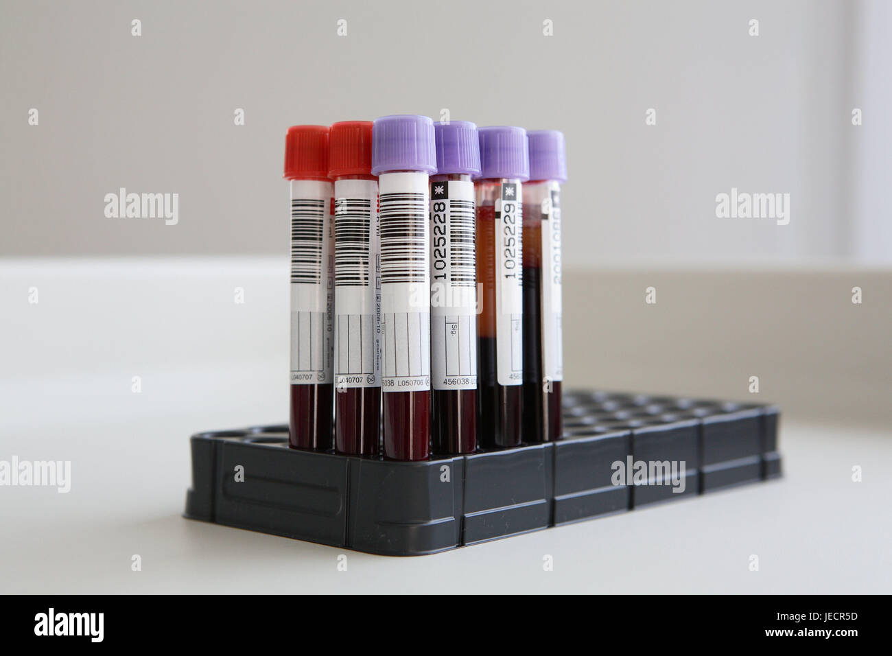 Laboratory, rehearsal stand, test tube, blood, medicine, hospital