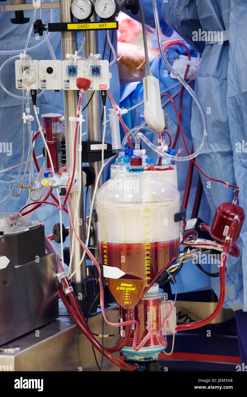 Cardiopulmonary Bypass High Resolution Stock Photography and Images Alamy