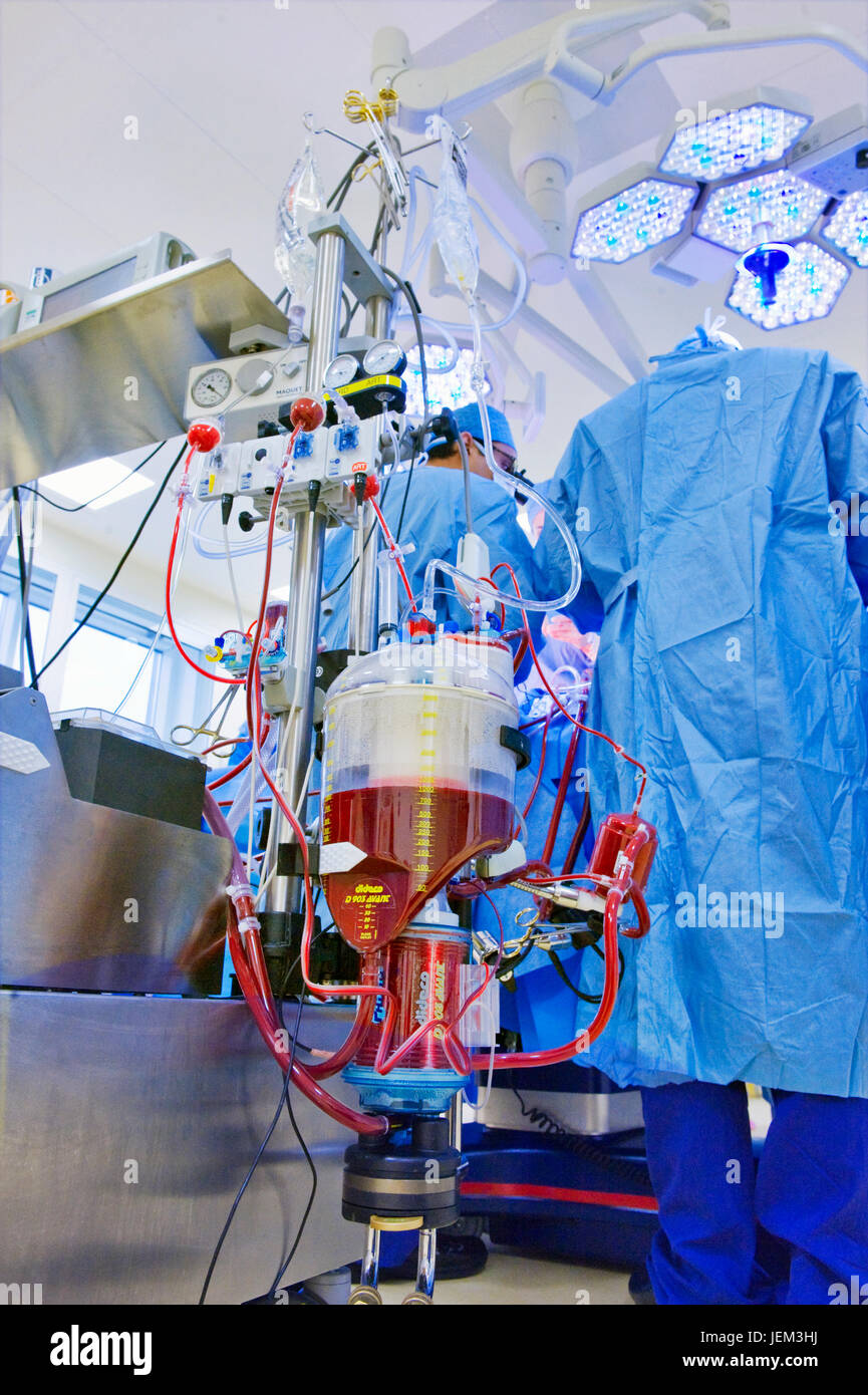 Blood reservoir of perfusion machine which has taken over the heart & lung functions of the patient having Coronary Artery Bypass Graft surgery. Stock Photo