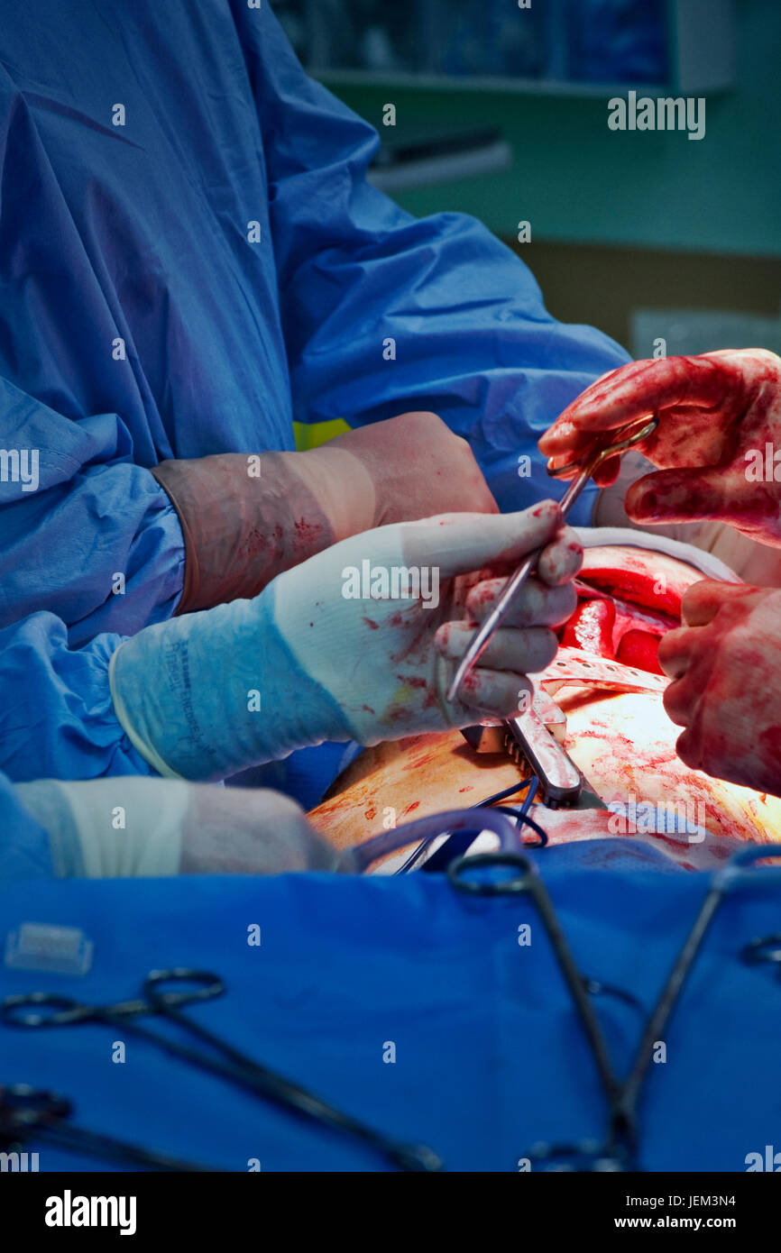 Surgical operating department practitioners are the principal surgical assistant and handle all the surgical instruments during a procedure. Stock Photo