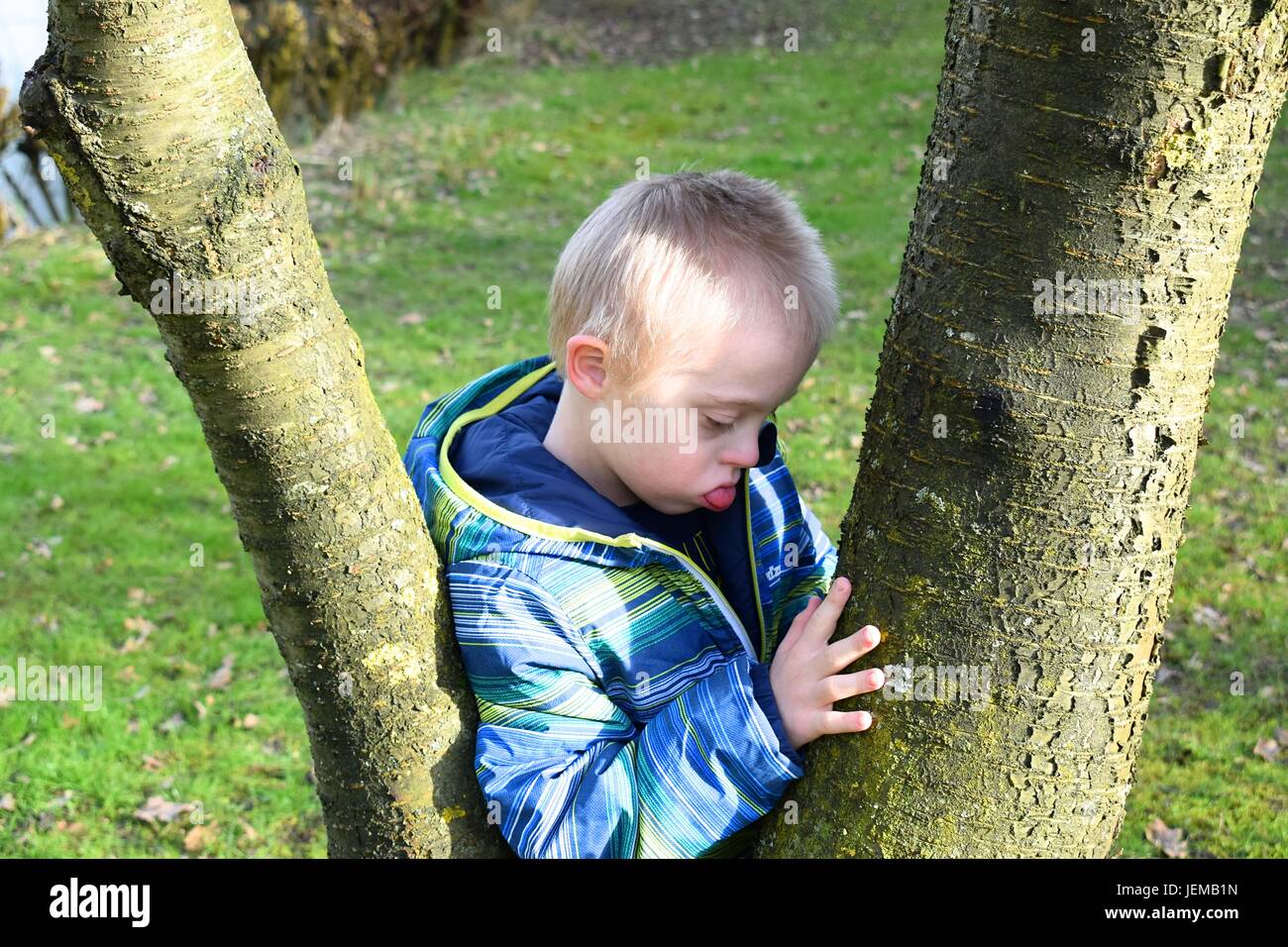 Thoughtful boy with syndrome down who hugs trees. Stock Photo