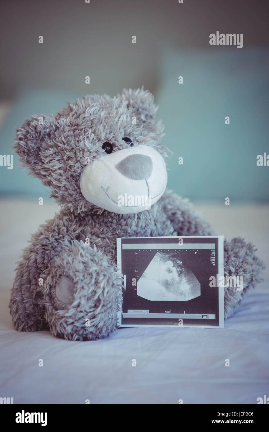 ultrasound teddy bear