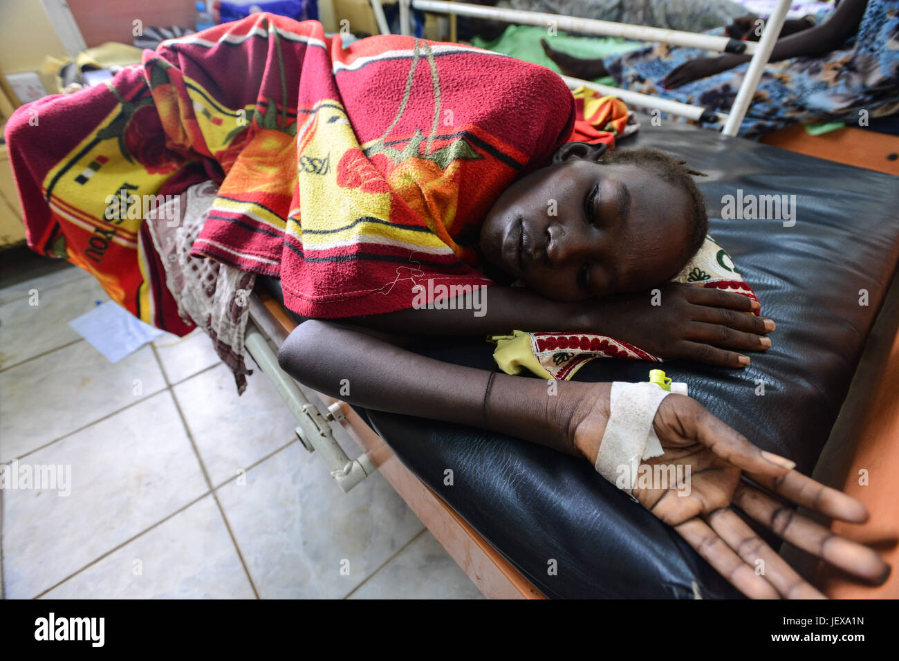 June 28, 2017 - Juba, Jubek, South Sudan - Esterina Wosuk, 18. lays on bed after giving birth via cesarea due to fistula  in the Juba general hospital in South Sudan Wednesday where more than half the population is suffering from a severe humanitarian crisis including near-famine. The doctors in this hospital held a montly salary of 20 USD a month. (Credit Image: © Miguel Juarez Lugo via ZUMA Wire) Stock Photo