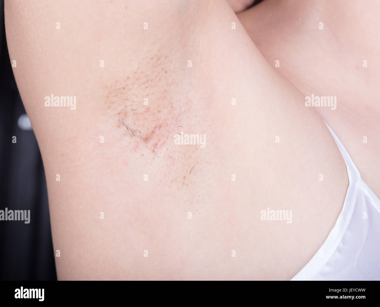 armpit of woman with grown hair Stock Photo