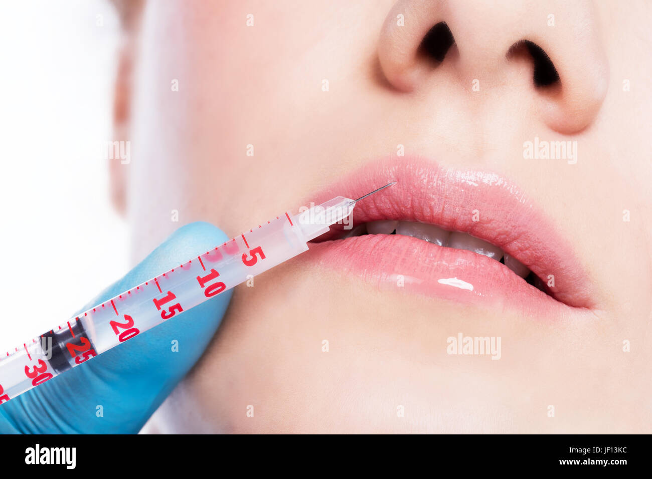 Aesthetic medicine. Young beautiful woman is having botox lips injection. Anti-aging skincare and plastic surgery concept. Stock Photo
