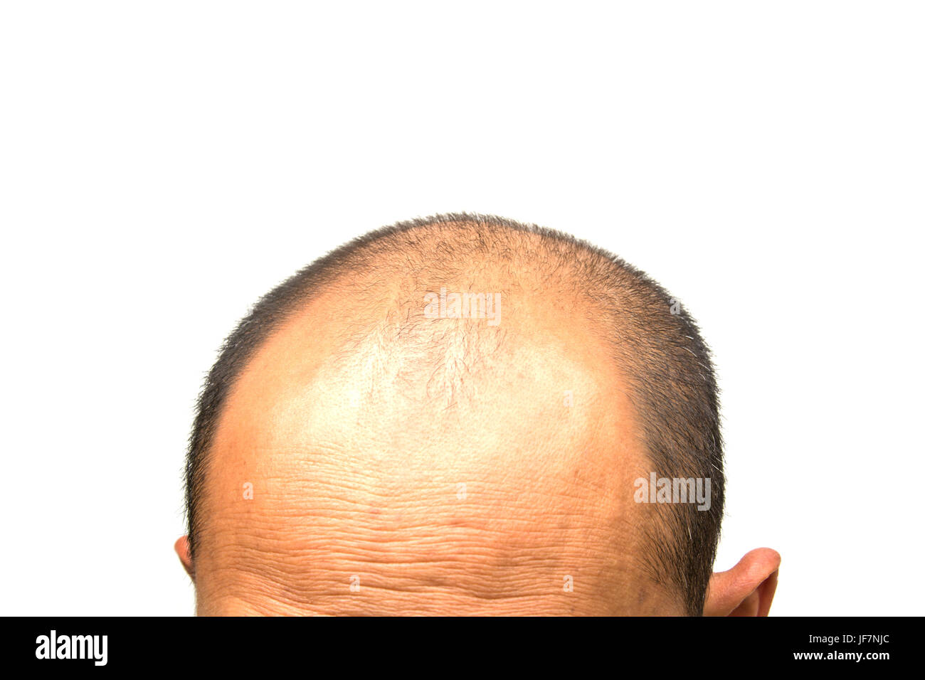 Head of man lose one's hair, glabrous on his head for elderly man Stock Photo