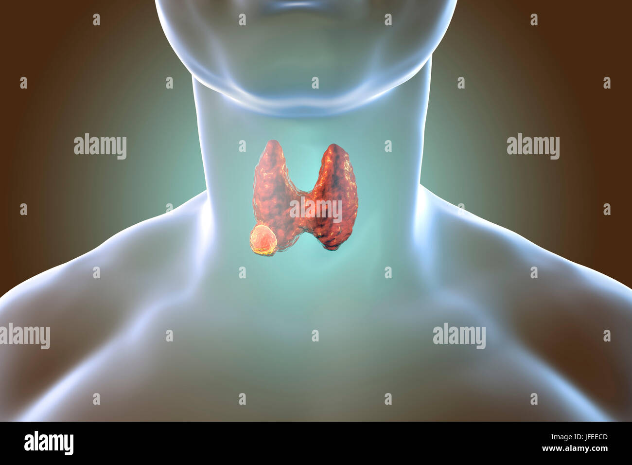 онкологический центр щитовидной железы