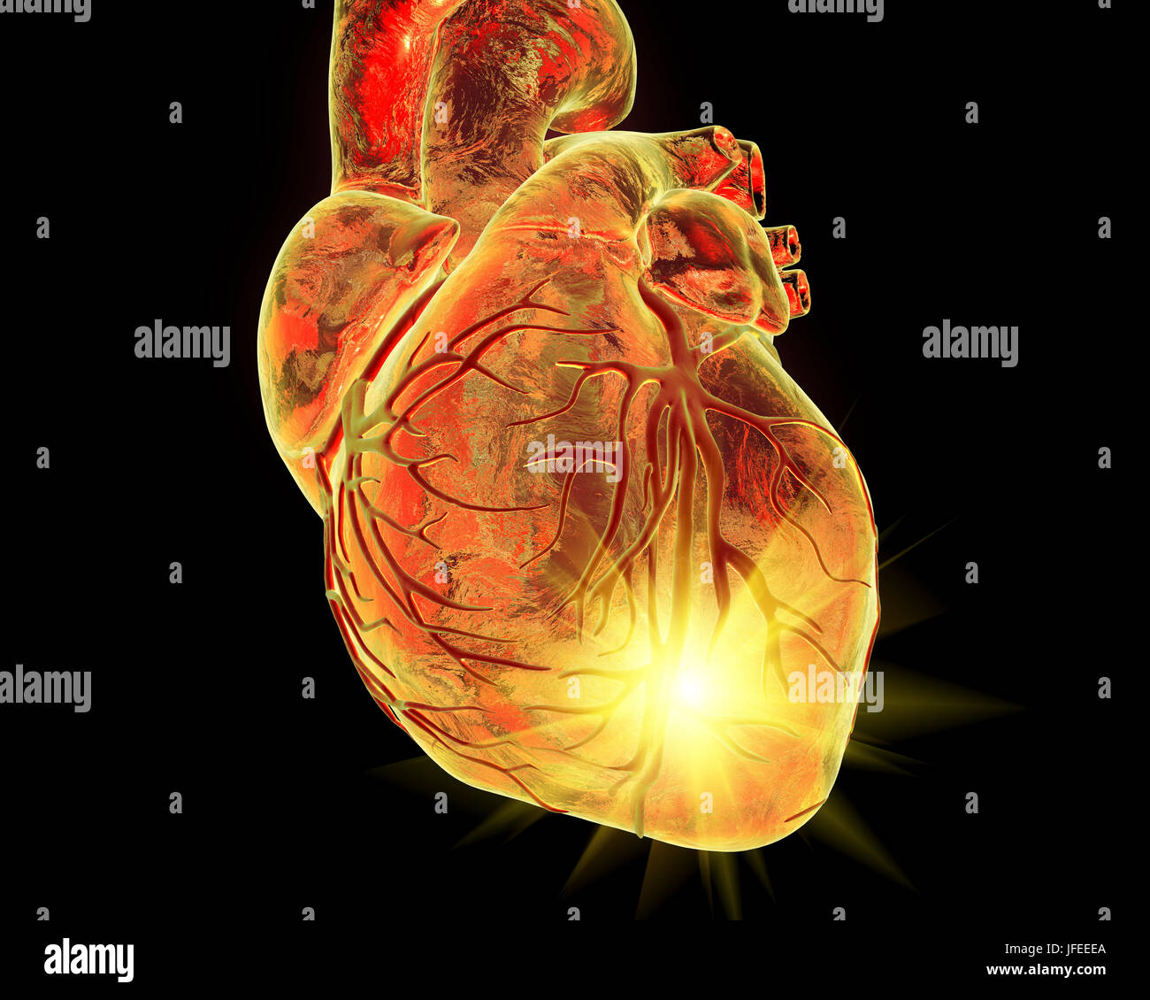 Heart attack, conceptual computer illustration. Stock Photo