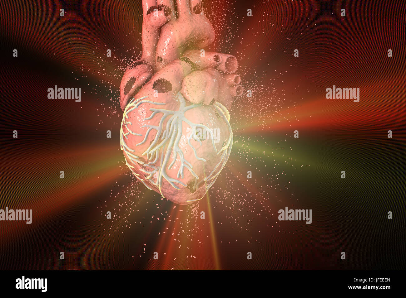 Heart destruction. Conceptual computer illustration that can be used to illustrate heart diseases. Stock Photo