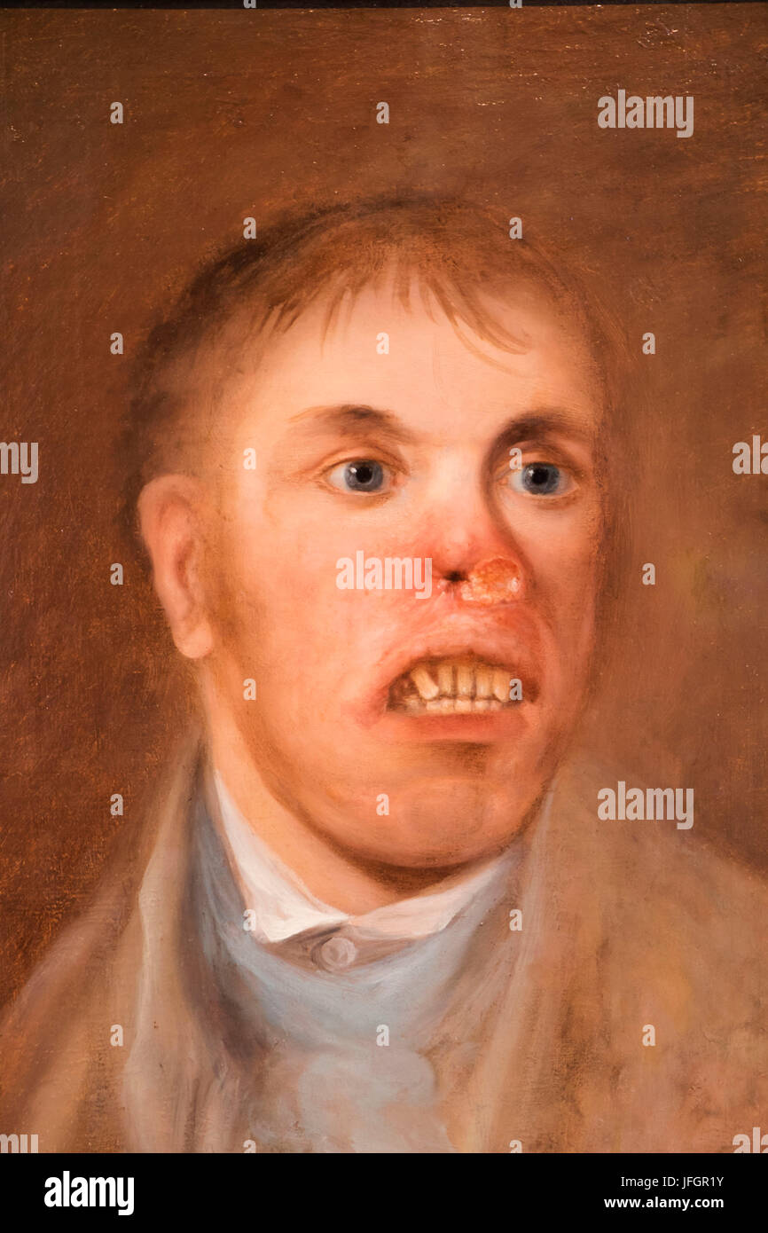 England, London, The Wellcome Collection, The Reading Room, Portrait of Mr J Kay Afflicted with a Rodent Disease c1820 Stock Photo