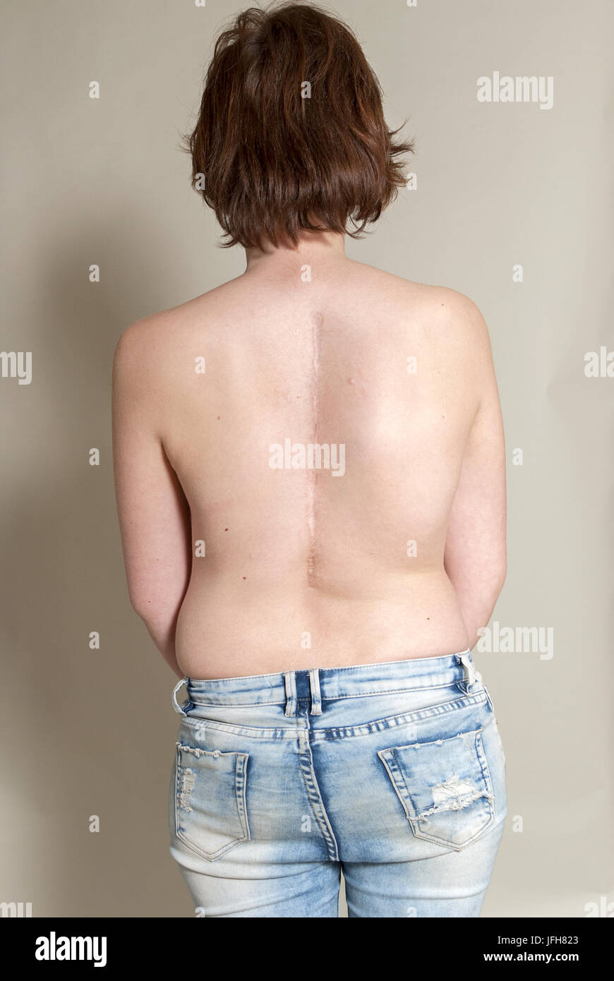 Woman having pain, muscle or chronic nerve pain in her back, sitting on  chair. Diseases of musculoskeletal system, spine, scoliosis, osteoporosis  Stock Photo - Alamy