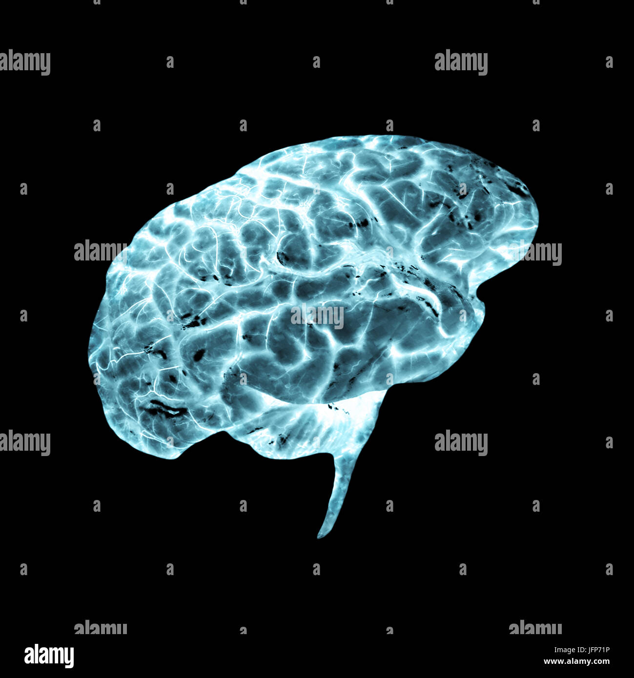 3D illustration radiograph of a human brain Stock Photo - Alamy