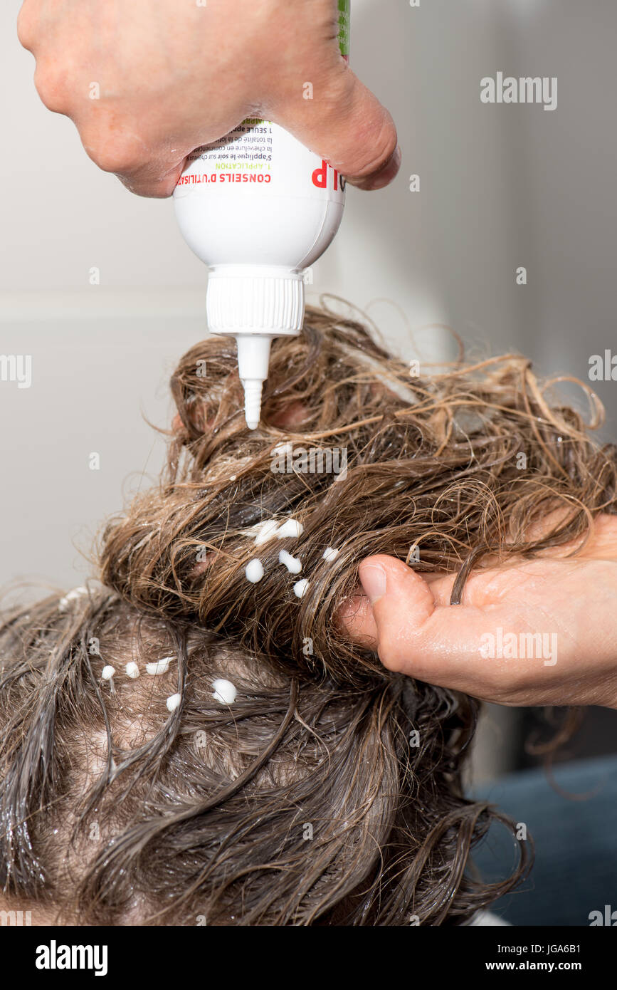 Treatment against lice on a child Stock Photo Alamy