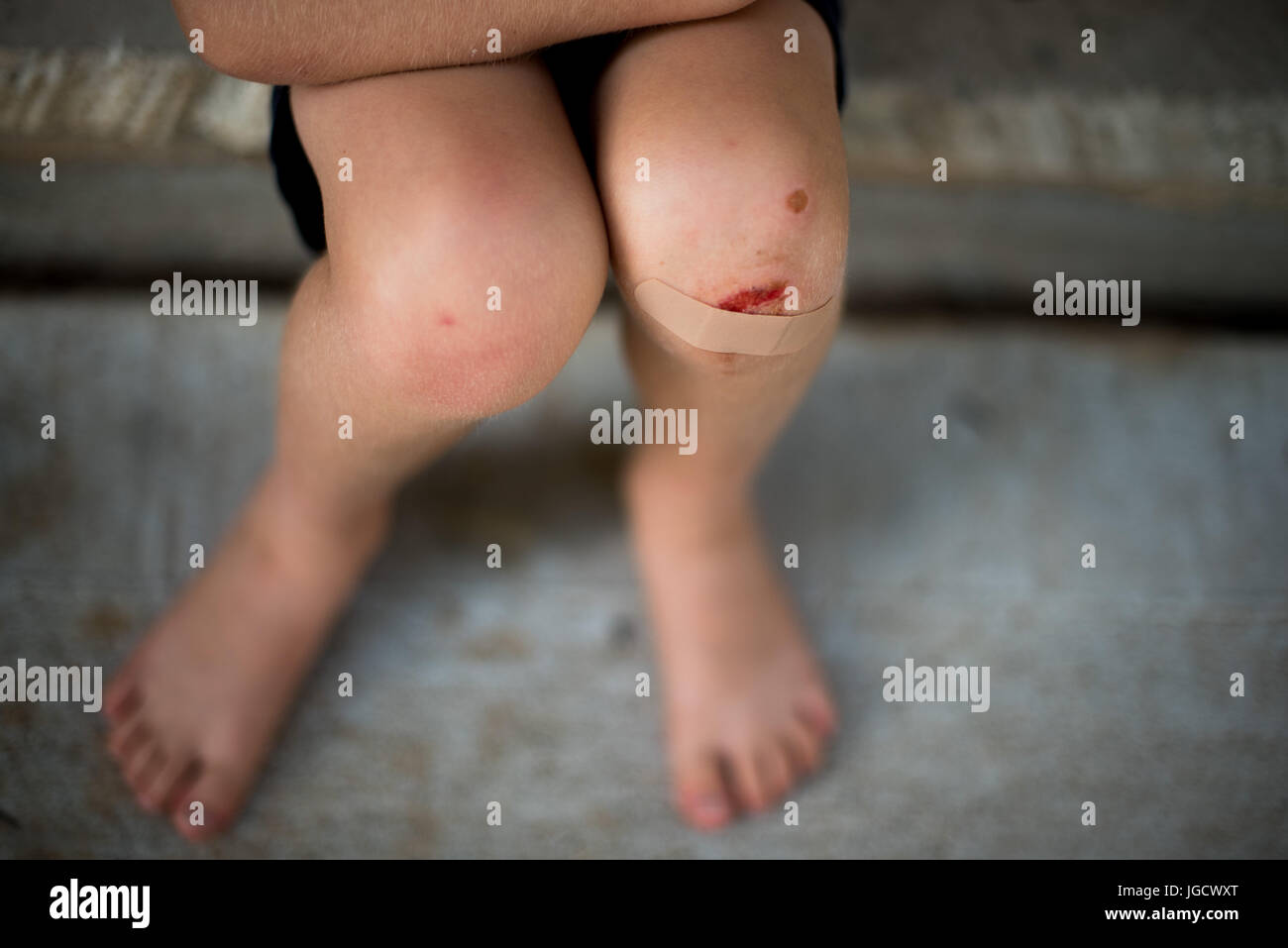 Cut knee hires stock photography and images Alamy