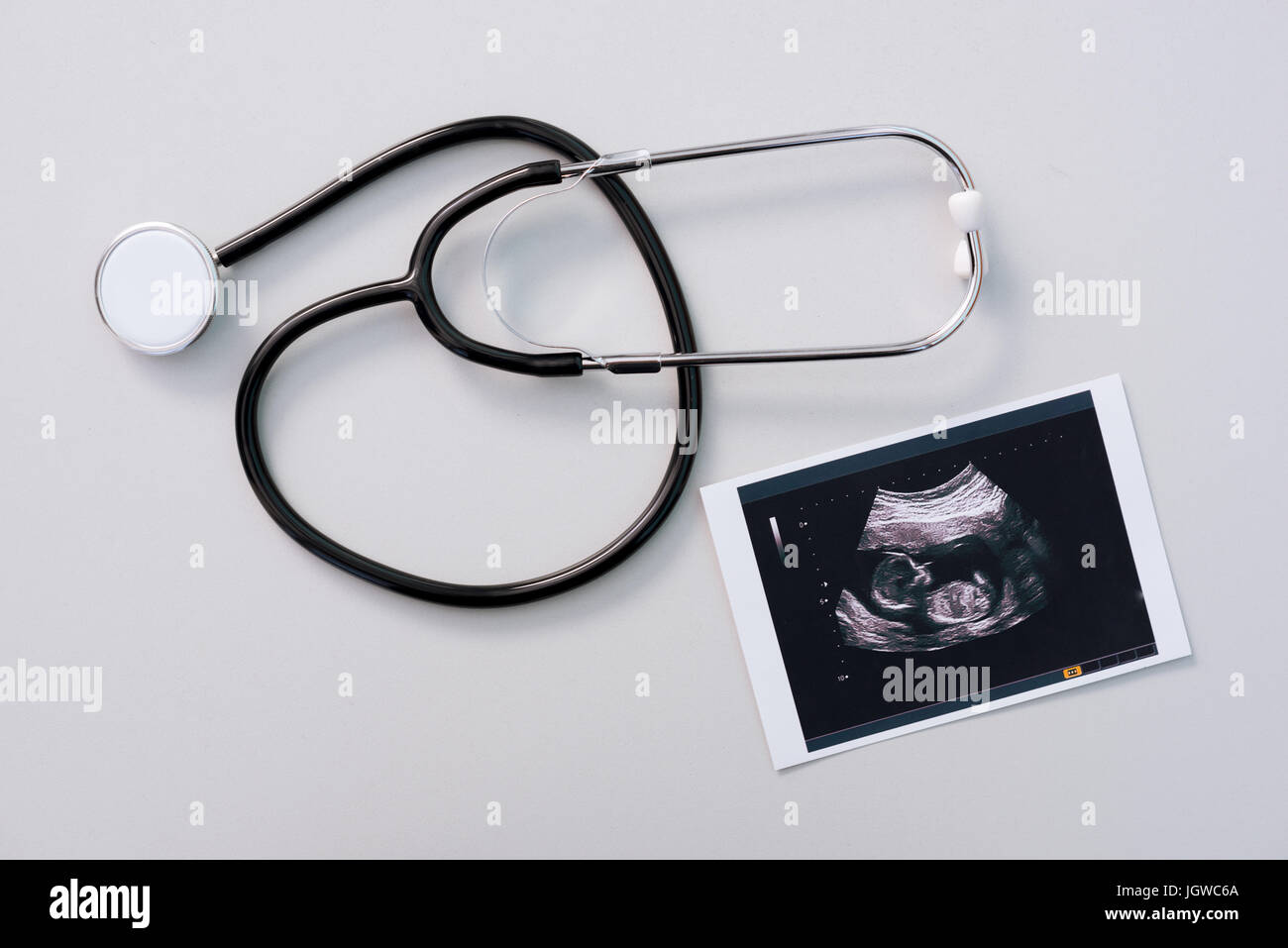medical stethoscope with ultrasound investigation result on tabletop Stock  Photo - Alamy