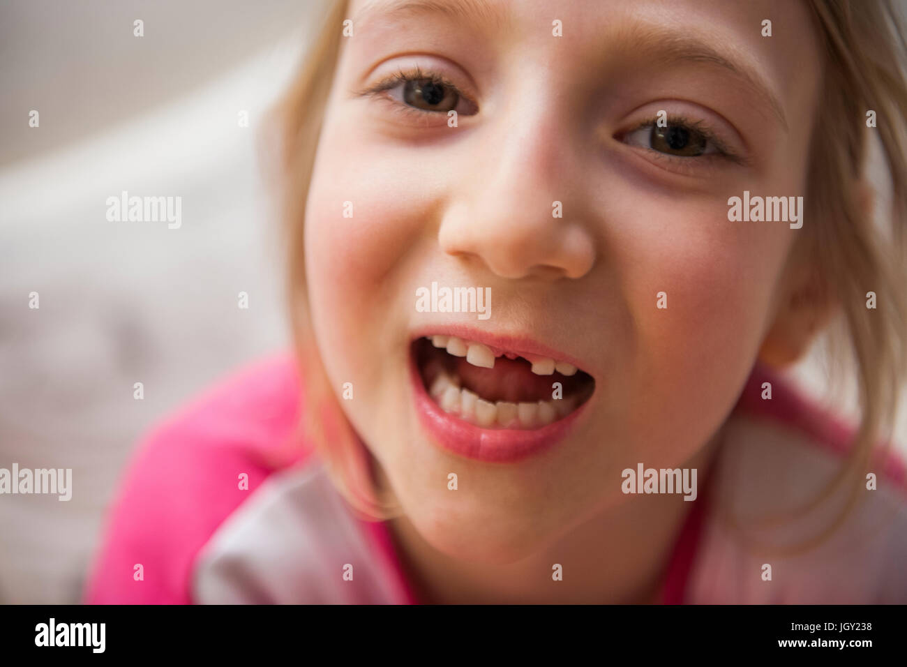 Portrait of girl with missing tooth looking at camera mouth open Stock Photo