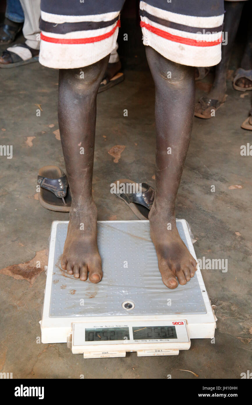 Kiryangondo refugee camp. Malnutrition prevention program run by Concern worldwide. Uganda. Stock Photo