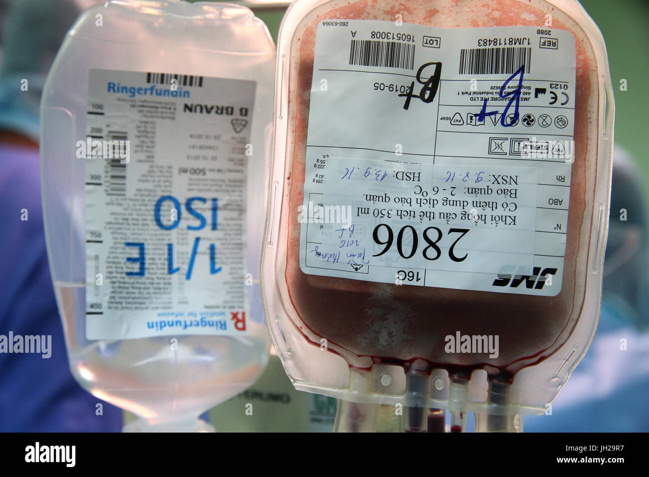 Operating theater.  Blood transfusion. Ho Chi Minh City. Vietnam. Stock Photo