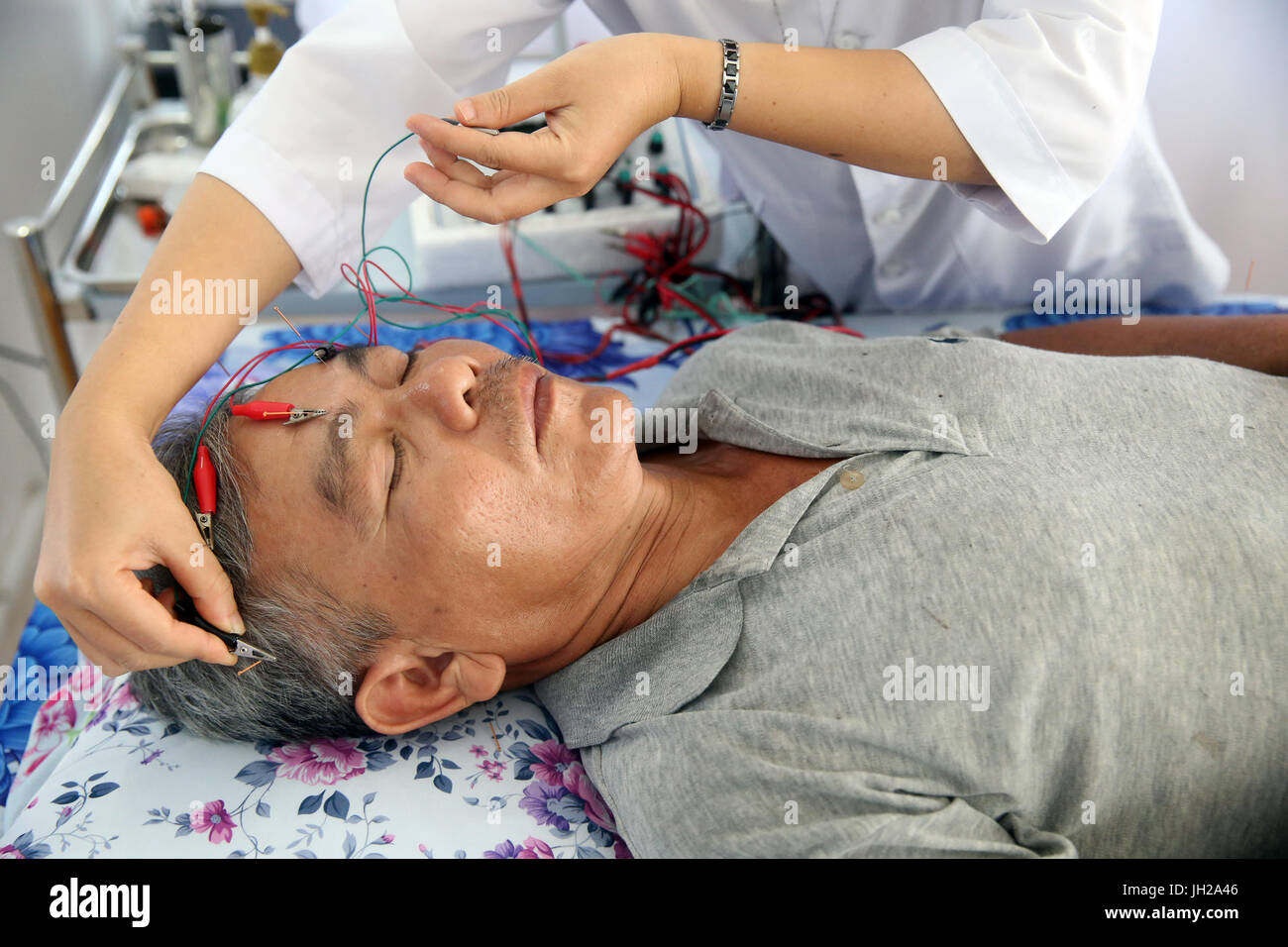 Vietnamese traditional medicine clinic. Acupuncture. Cu Chi. Vietnam