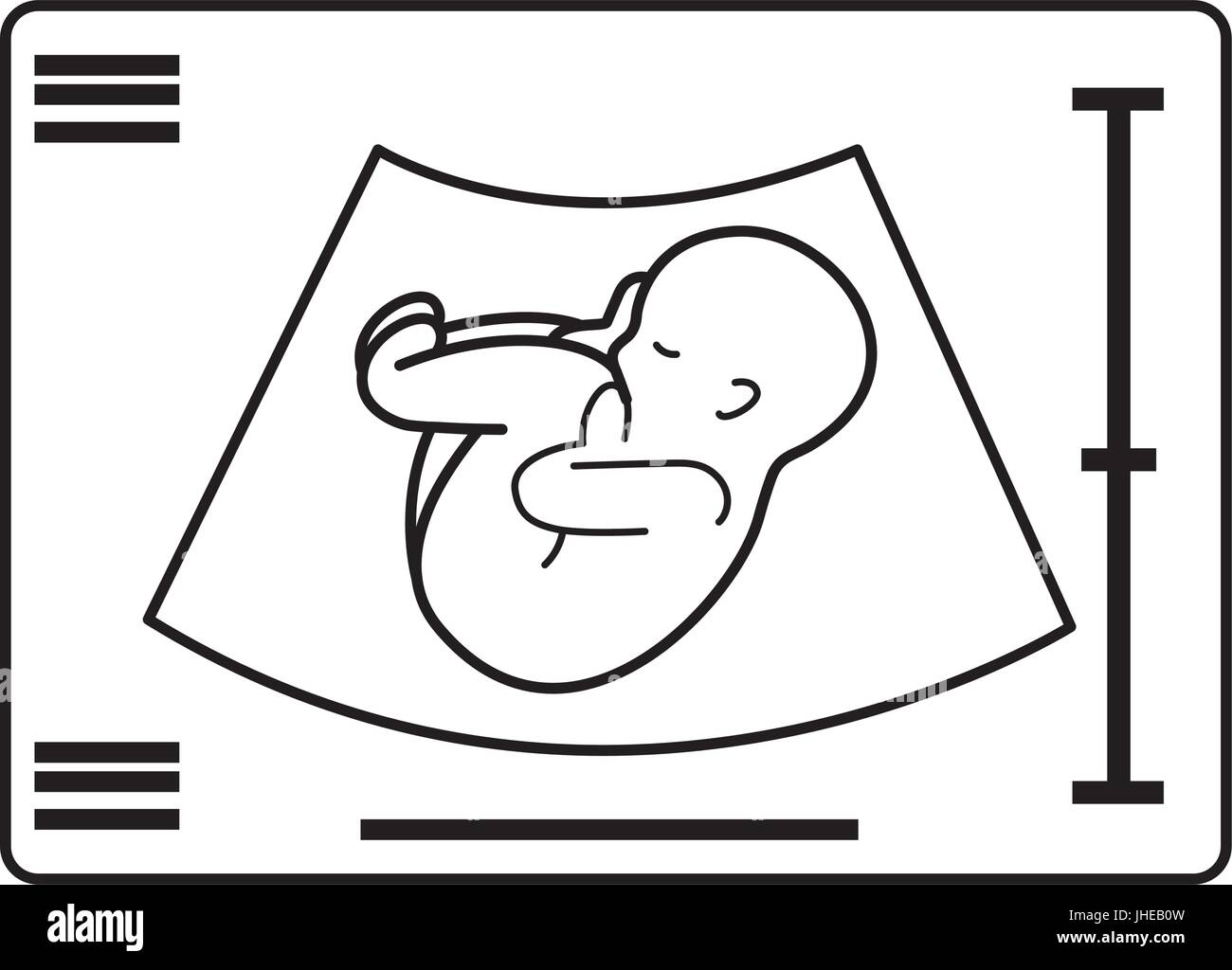 Ultrasound Black and White Stock Photos & Images - Alamy