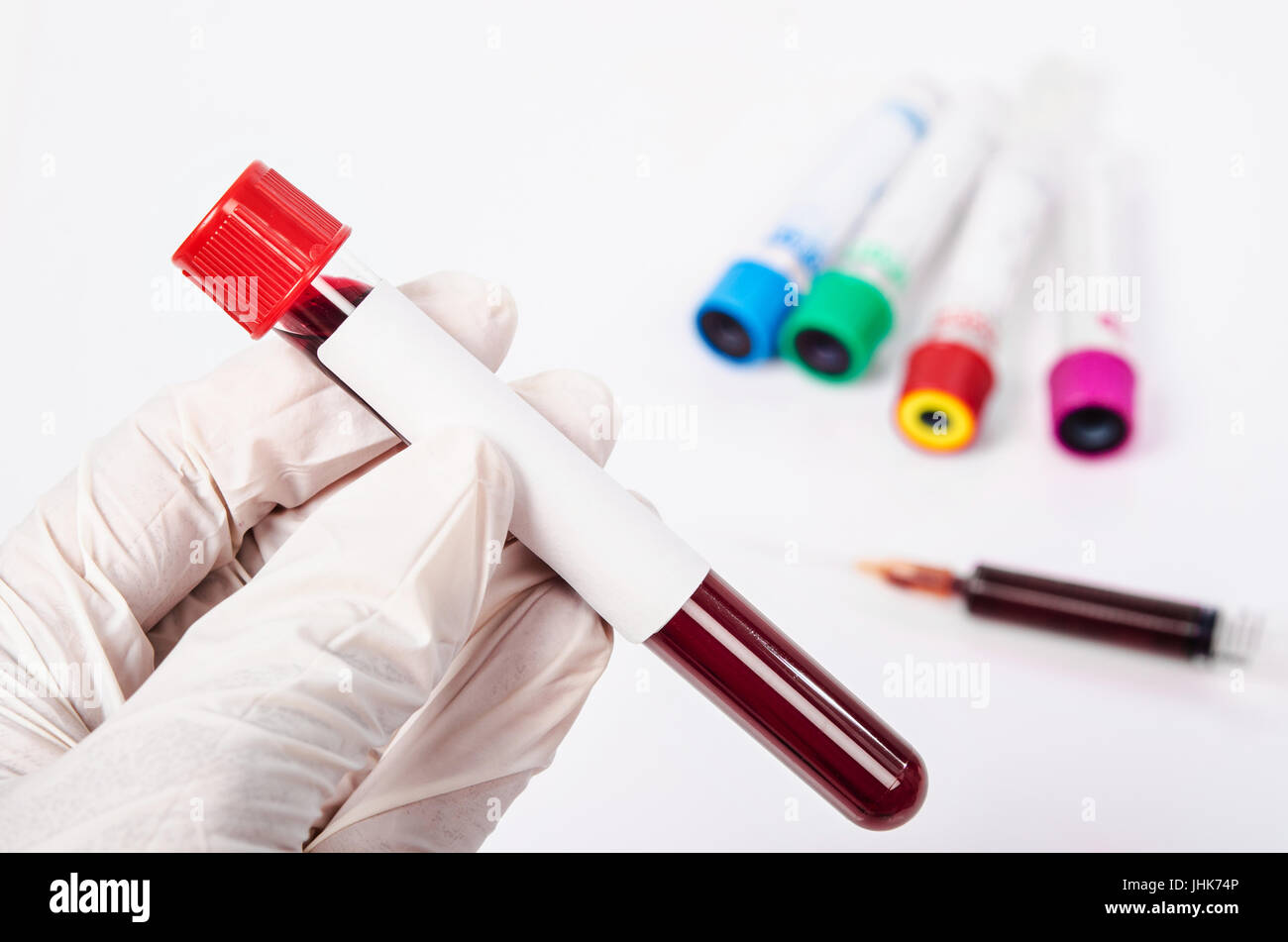 Hand holding test tube with blood plasma ready for testing in laboratory. Stock Photo