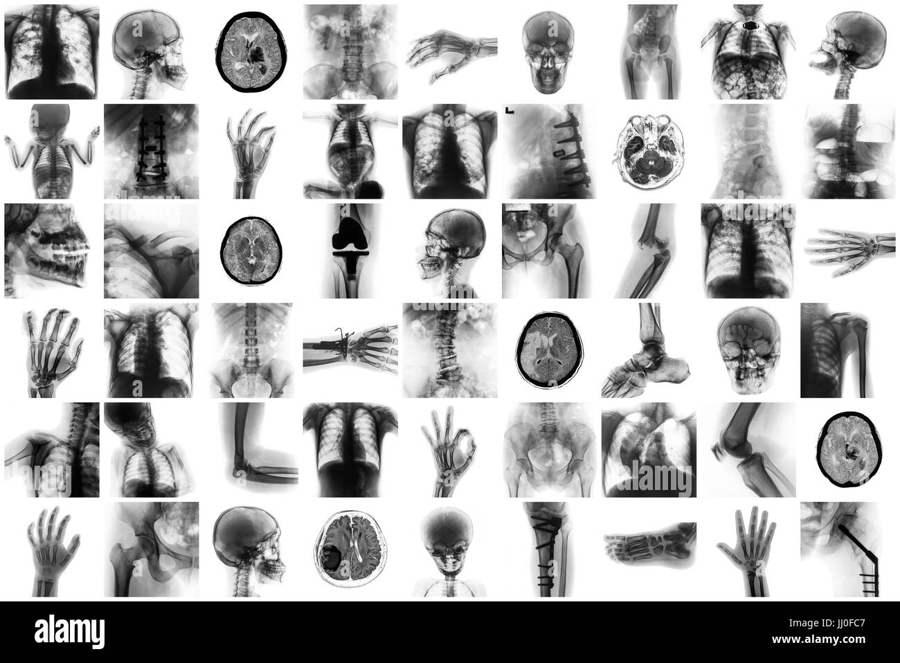 X-ray multiple part of human and many medical condition and disease . Stock Photo