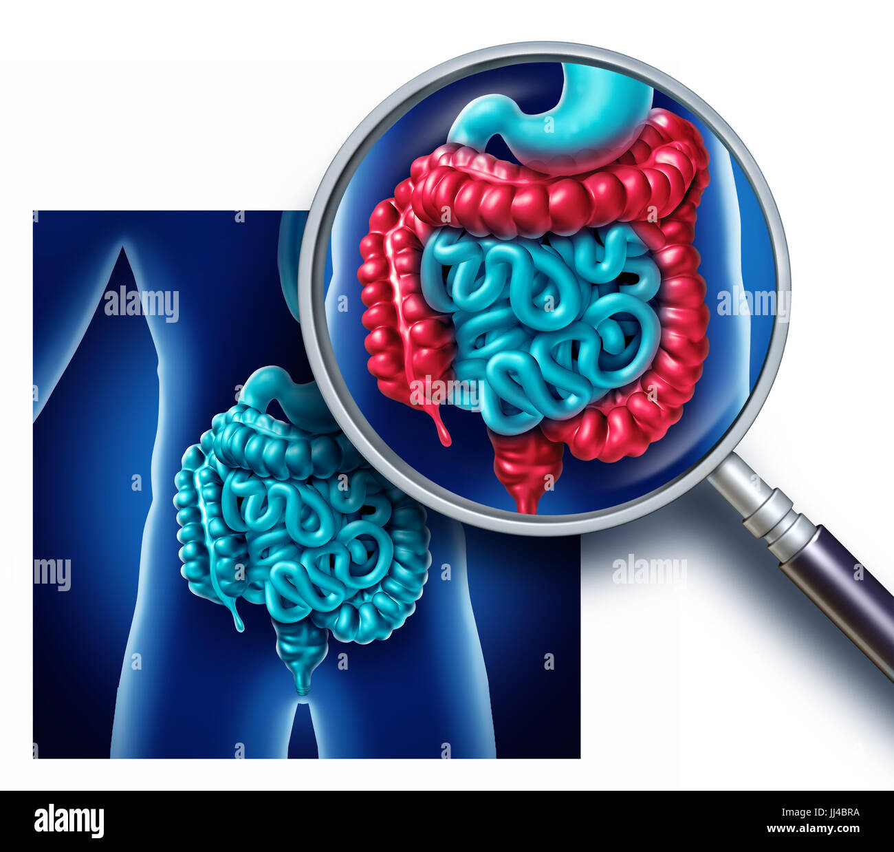 Colon and large bowel pain and intestine Illustration as a digestive system organ and digestion body part inflammation concept with rectum. Stock Photo