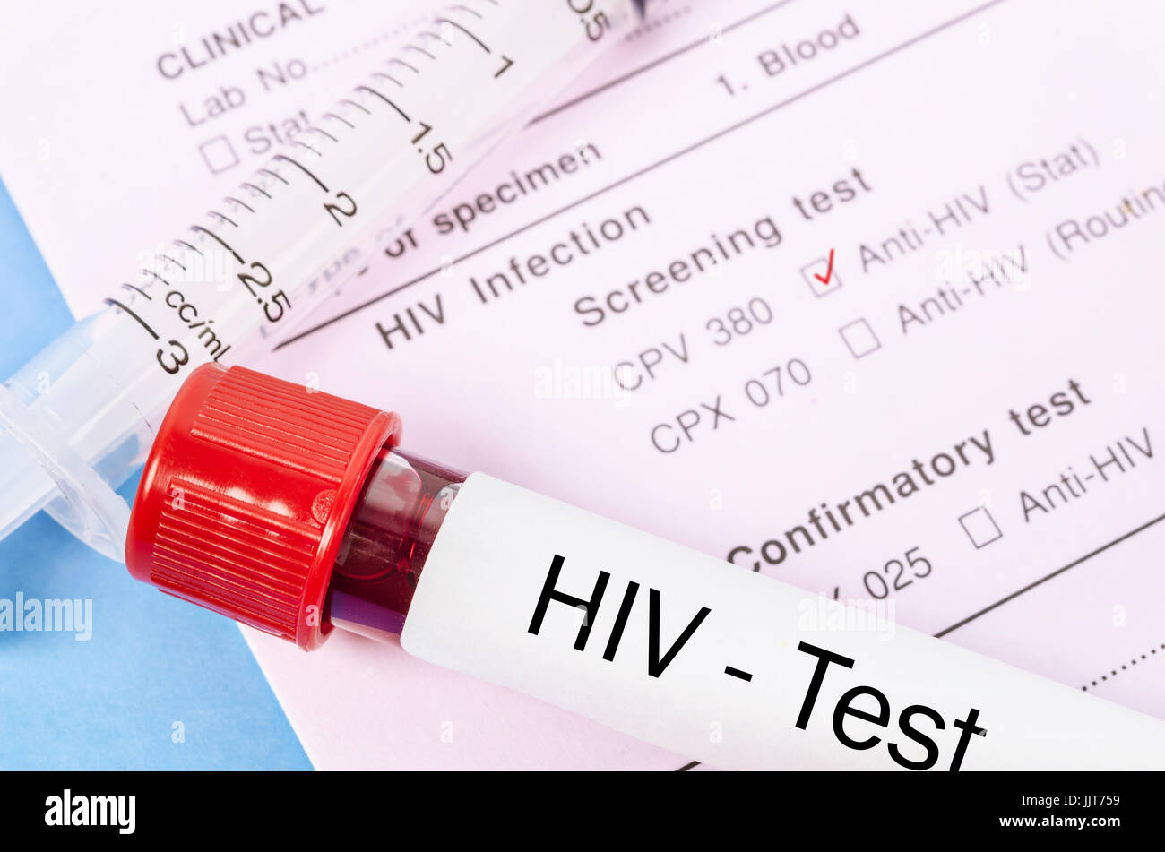 Sample blood collection tube with HIV test label on HIV infection
