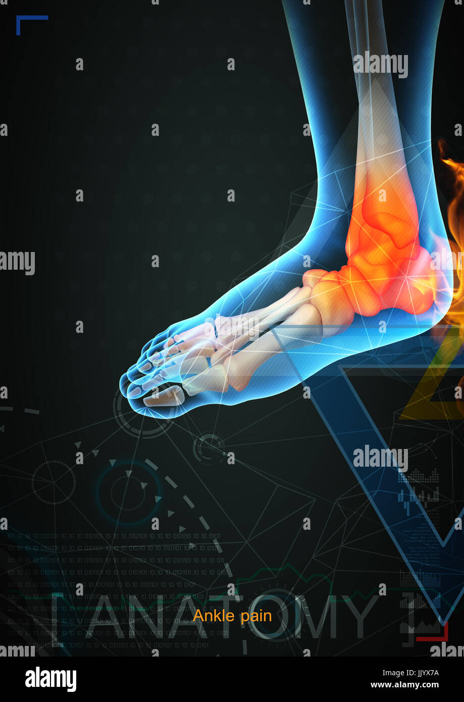 3d illustration of ankle pain by x- ray on background Stock Photo - Alamy