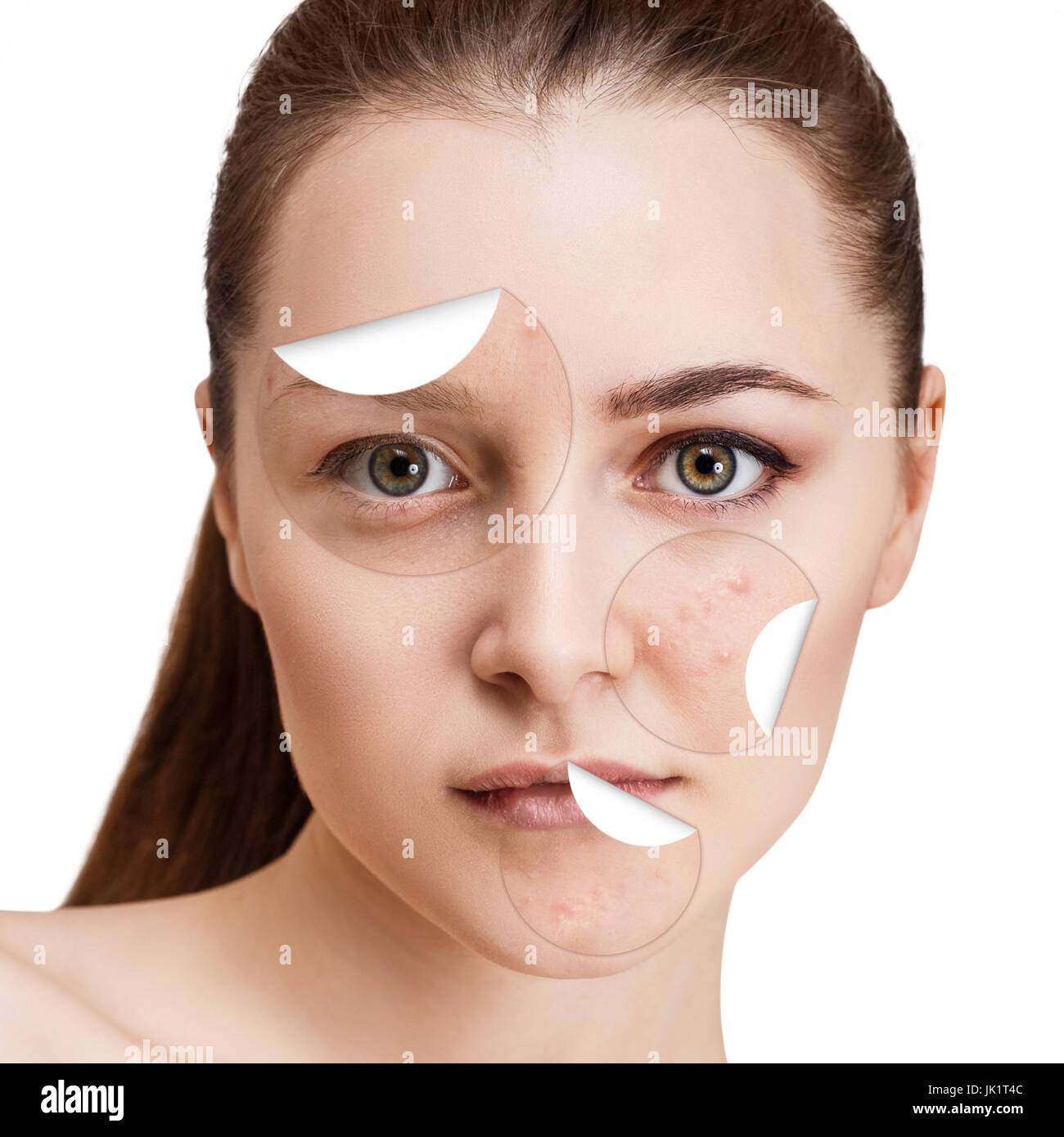 Circles with acne unstick from healthy skin. Stock Photo