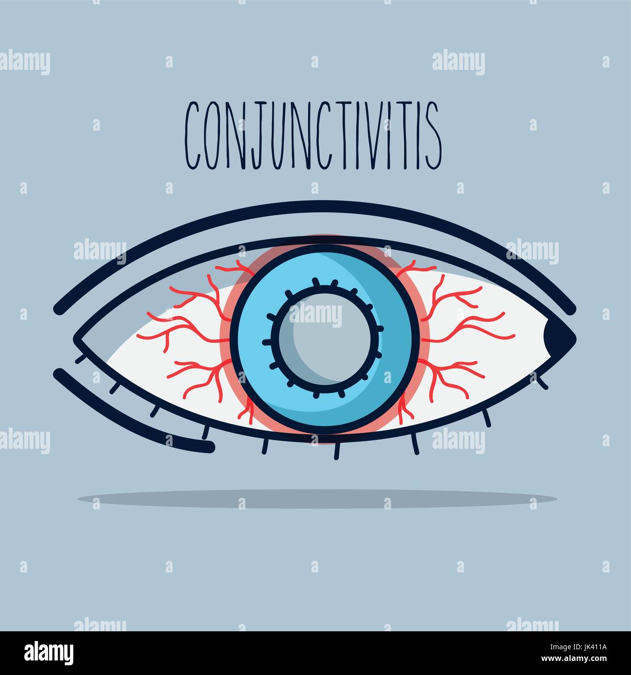 Conjunctivitis Pink Eye
