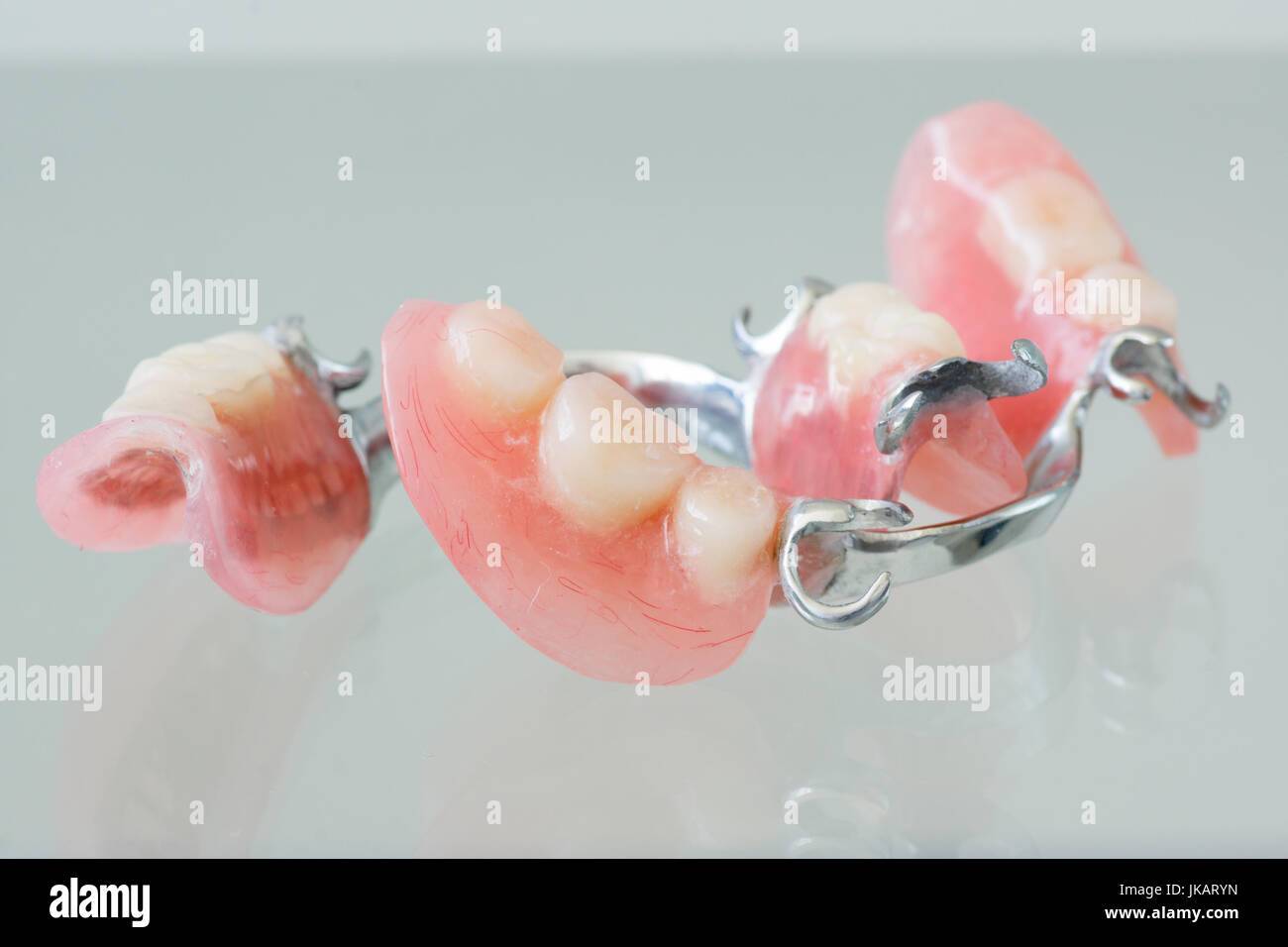 Clasp denture with a metal arc and artificial teeth Stock Photo