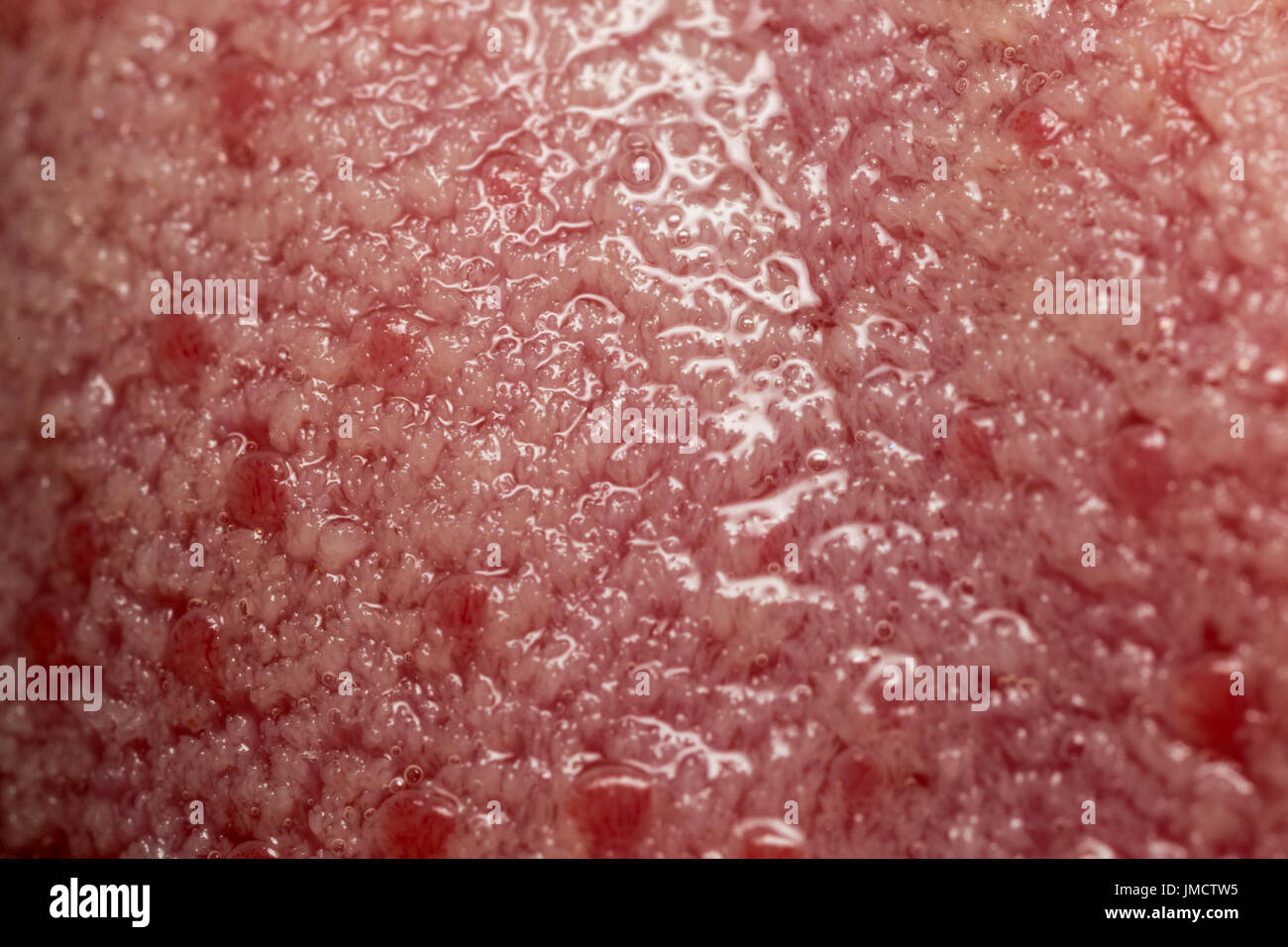 Macro Photo of Taste Buds on human Tongue Stock Photo