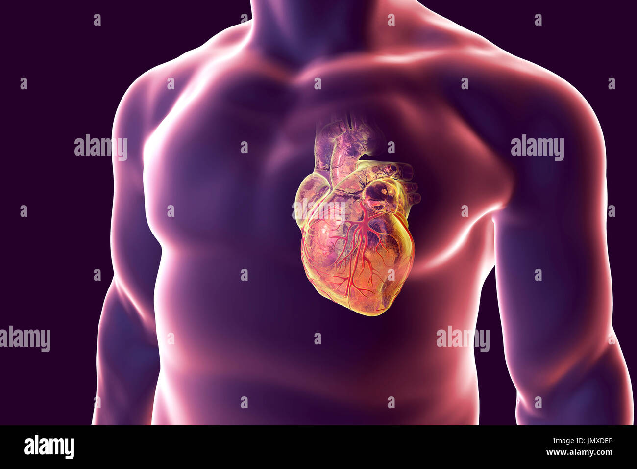Heart attack, conceptual computer illustration. Stock Photo